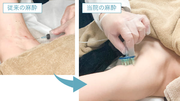 森の中で両腕をあげている健康的な女性