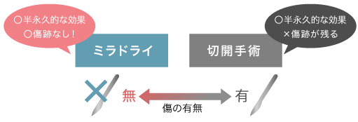 ミラドライと他の治療の比較図