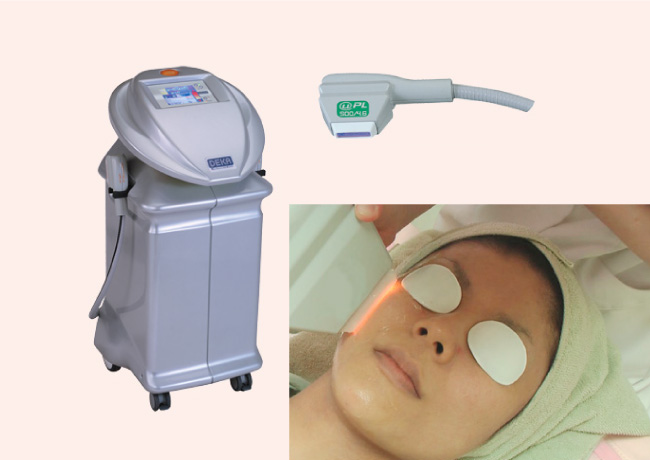 藤野クリニックのシミ治療 フォトシルクプラス